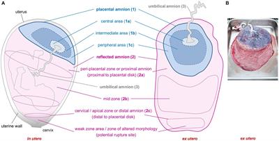 Sub-Regional Differences of the Human Amniotic Membrane and Their Potential Impact on Tissue Regeneration Application